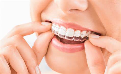 Invisalign is fast and convenient