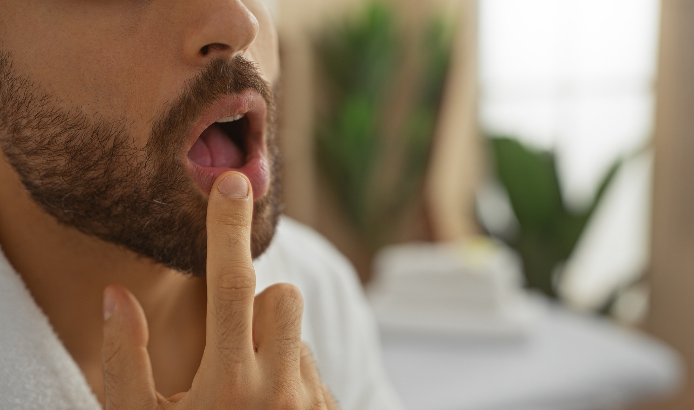 Cold Sore Laser Treatment