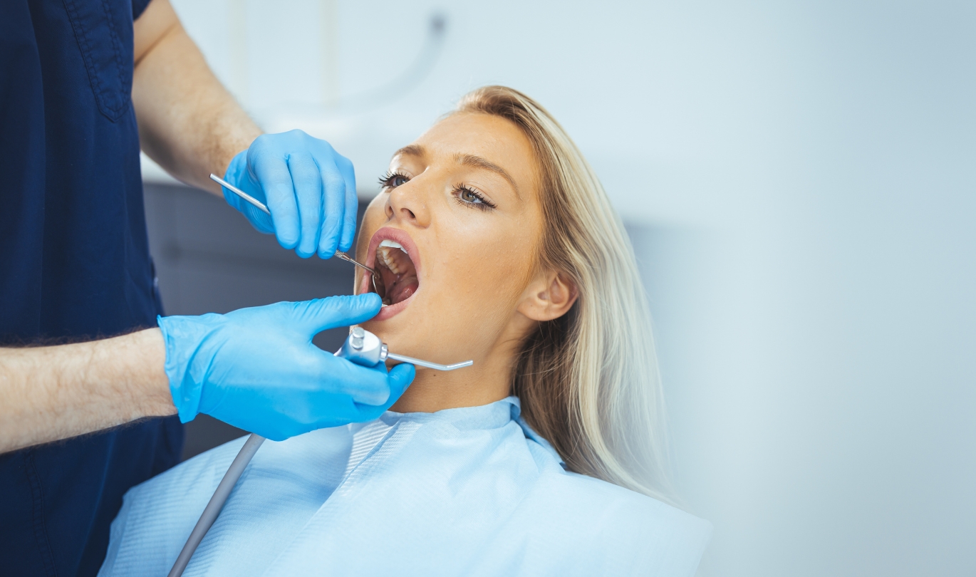 Inlays and Onlays (Overlays)