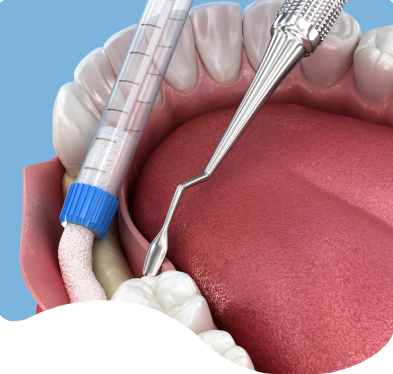 Treatments - London Holistic Dental Centre