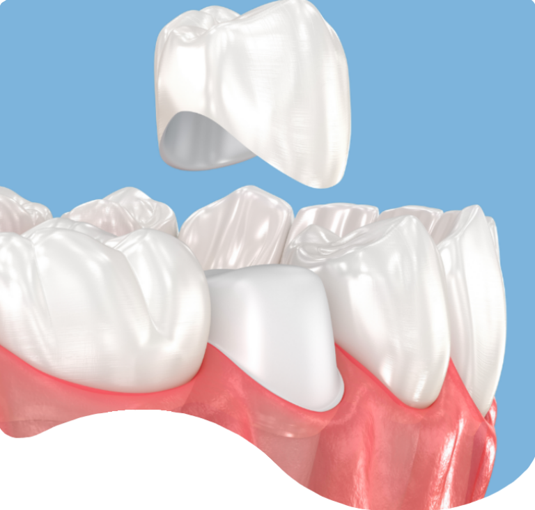 Treatments - London Holistic Dental Centre