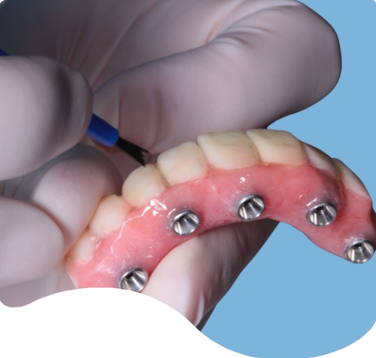 Treatments - London Holistic Dental Centre