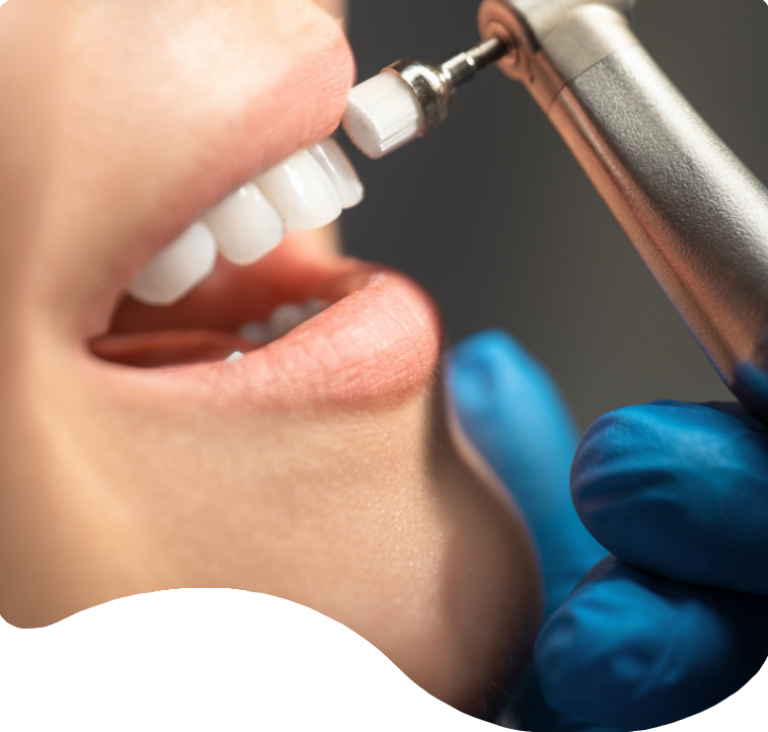 Treatments - London Holistic Dental Centre