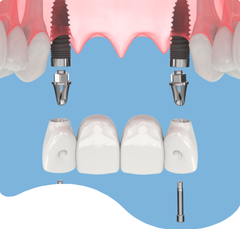 Treatments - London Holistic Dental Centre
