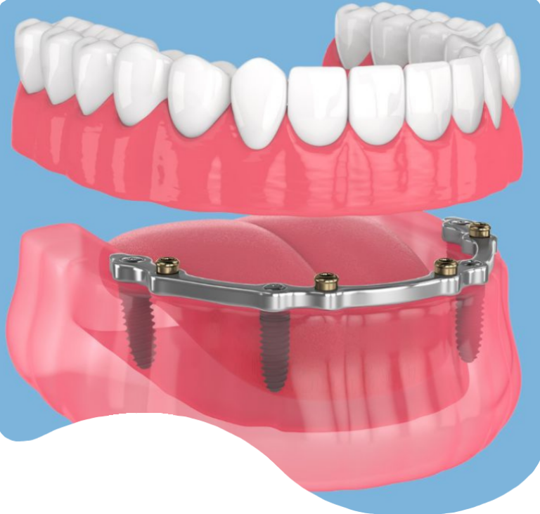 Treatments - London Holistic Dental Centre