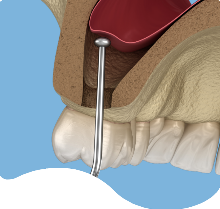 Treatments - London Holistic Dental Centre