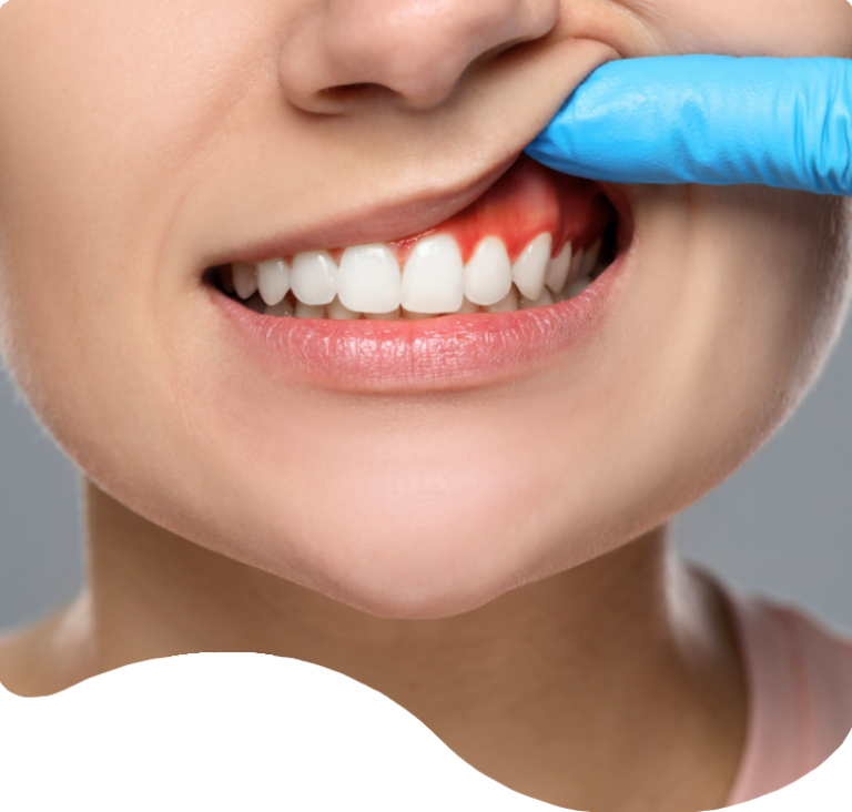 Treatments - London Holistic Dental Centre