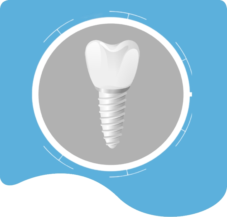 Ceramic (Zirconia) Dental Implants